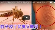 被蚊子咬了 1分钟快速止痒 10种天然材料帮助你（视频）