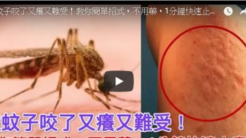 被蚊子咬了 1分鐘快速止癢 10種天然材料幫助你（視頻）