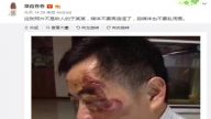 昆山反杀案爆新料 网传脸伤人非“龙哥终结者”