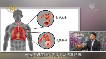 談古論今話中醫：咳不停竟是氣喘 中醫治療可緩解