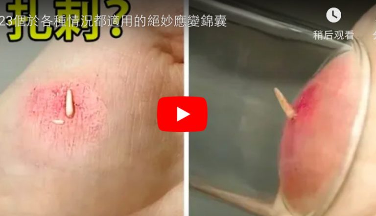 手指扎根刺怎麼辦？23個各種情況都適用的絕妙應變錦囊