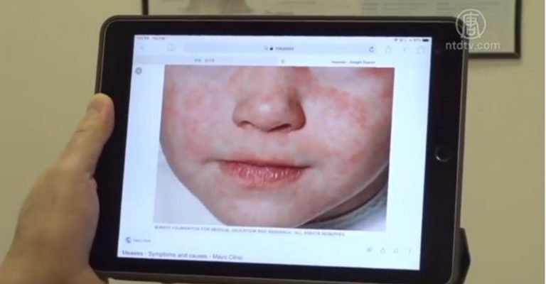 麻疹疫情持續 布魯克林又關兩所學校