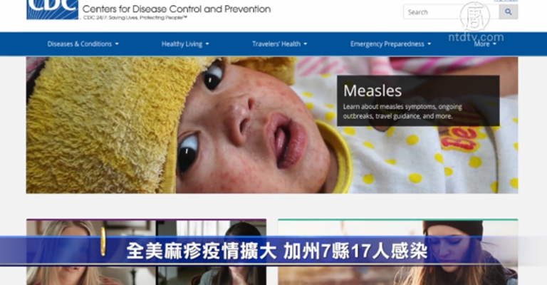 全美麻疹疫情擴大 加州7縣17人感染
