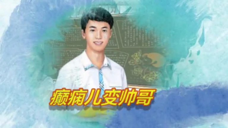 短視頻：癲癇兒變帥哥