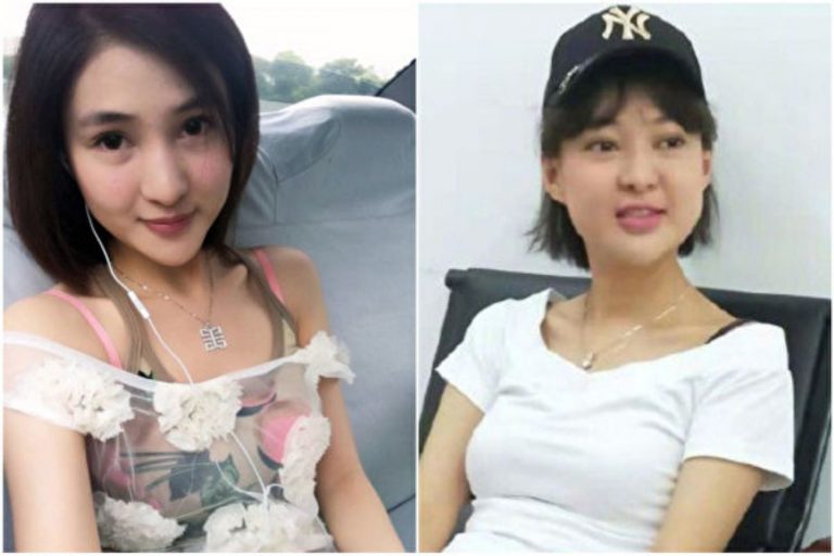 郭美美出獄後近照曝光 V臉變U臉引熱議