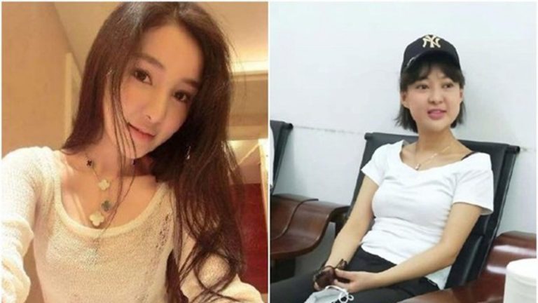 郭美美「重出江湖」照片瘋傳  臉腫一圈疑乾爹關照