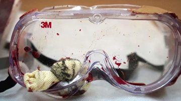 反送中少女被打爆眼球  最重要物證曝光