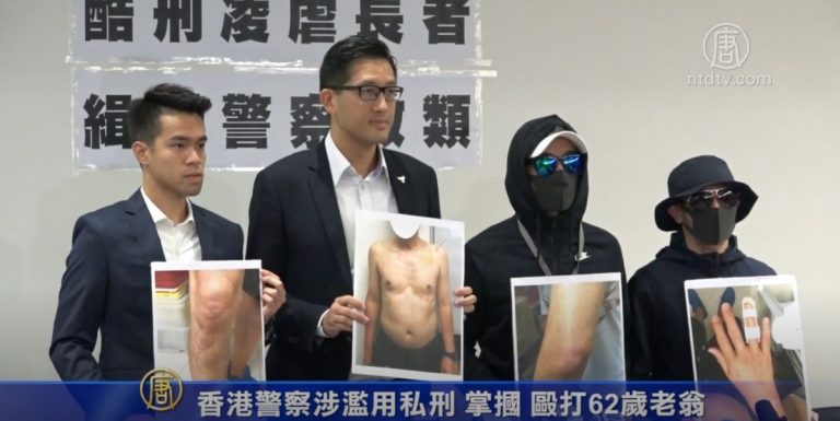 港警病房濫用私刑曝光 殘忍凌虐六旬翁被拍下