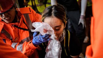 【今日点击】港警叫爆眼少女“提供报告” 避答瞄头开枪