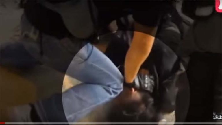 港青年被打掉門牙視頻曝光 警察按頭朝臉部打兩棍