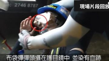 視頻證據 港少女爆眼一刻布袋彈插護目鏡（視頻）