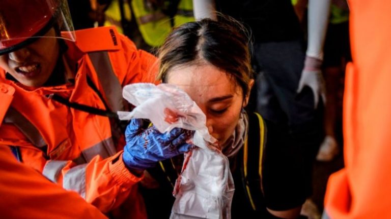 少女爆眼港警避答是否瞄頭 認射多發布袋彈（視頻）