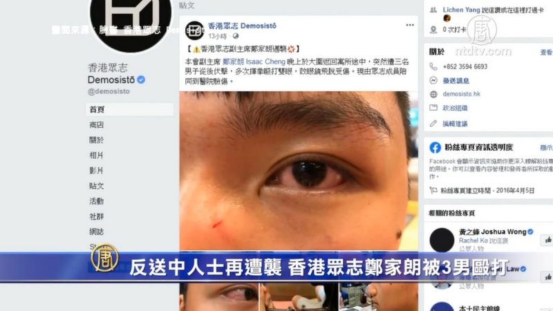 反送中人士再遭袭 香港众志郑家朗被3男殴打