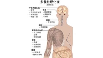 新方法可預防和逆轉多發性硬化症