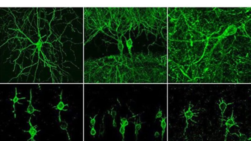 新型成像法可目击神经元工作过程