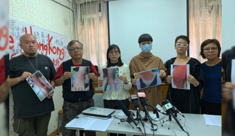 香港兒童接觸催淚煙或殘留物 最長入院五天