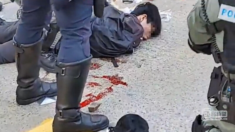 香港中槍男孩腎被打爆 一度失去心跳（視頻）