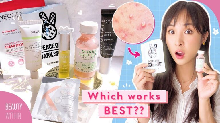 【Beauty Within】如何治療痘痘