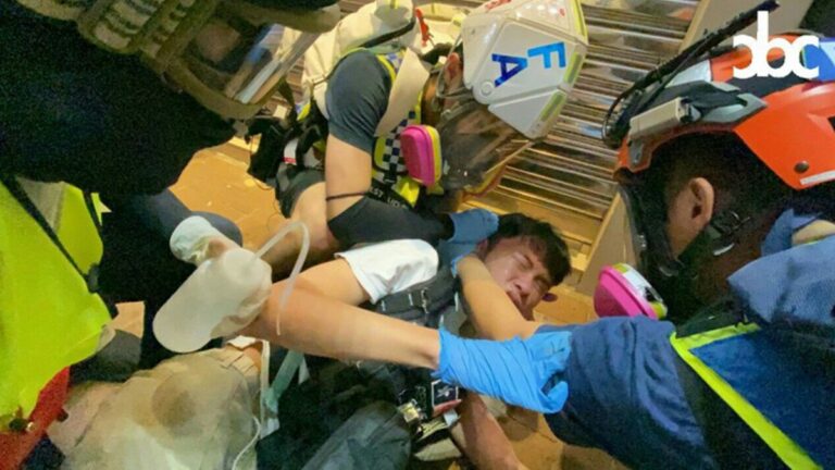 港急救員被中國製催淚彈炸傷 背部皮膚焦黑（視頻）