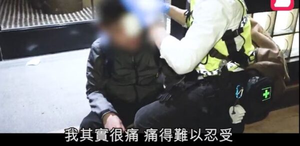 港警刻意“瞄头射” 27岁男子左眼中弹