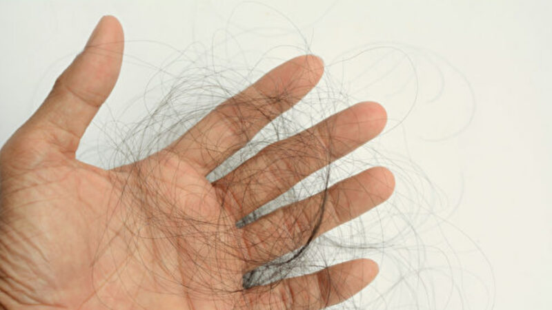減少落髮的養髮三步驟：一洗二吃三睡（組圖）