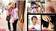 女记者遇袭案 港苹果日报悬赏50万全城缉凶