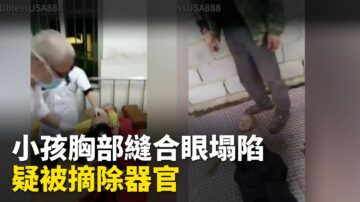 震惊！网传中国小孩尸体被缝 疑遭摘器官(视频)