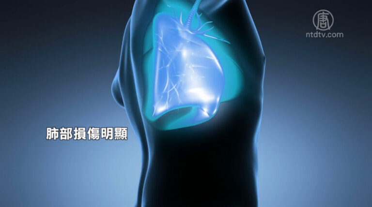 武漢公布首例新冠病毒屍檢報告