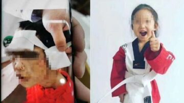 陸4歲女童遭繼母虐致腦出血 多處燙傷嘴唇被剪