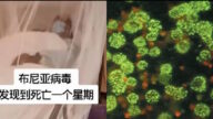《石涛聚焦》中共国再次爆发“新型布尼亚病毒”发病到死亡7天
