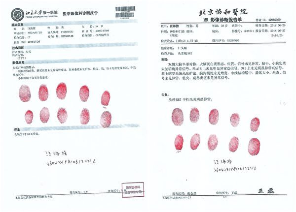 举报公安系统贪腐 江西男遭“脑控”12年