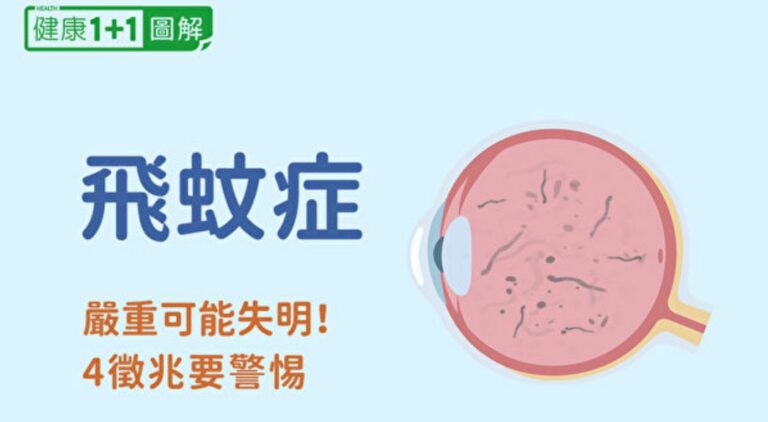 飛蚊症4徵兆要警惕！飛蚊症狀、成因和治療全圖解