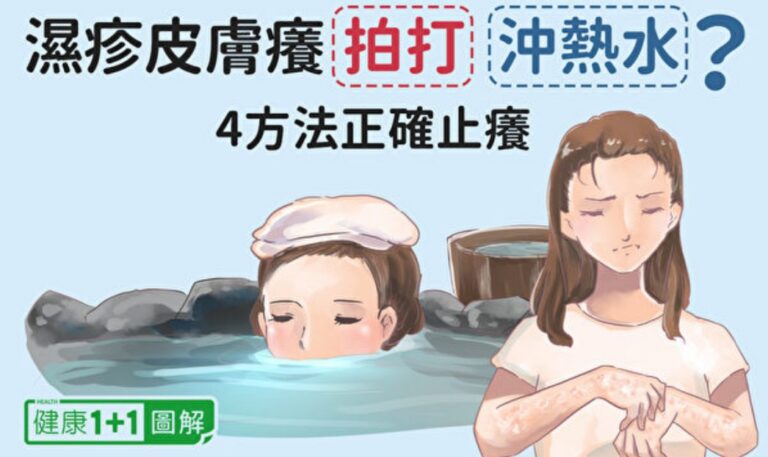 濕疹皮膚癢拍打、沖熱水都錯？4方法正確止癢