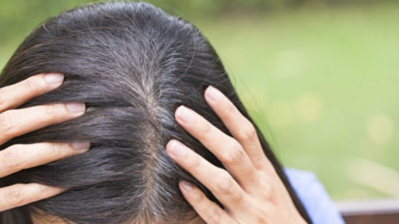 长白发可能是身体警讯 10种原因一定要当心