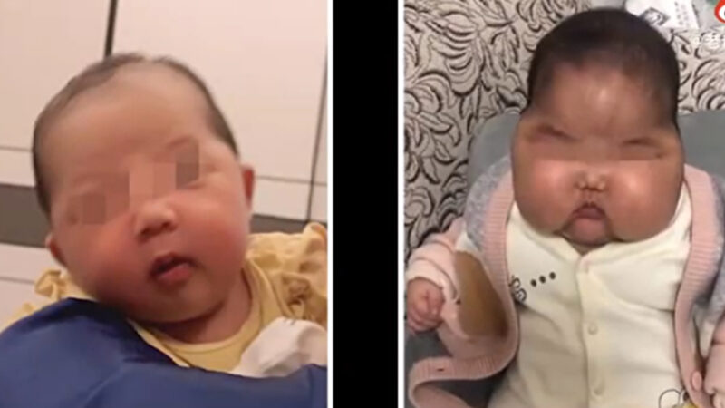 中國又現大頭娃娃 嬰兒霜含超强激素