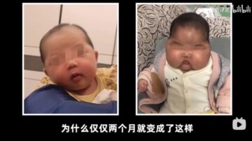 激素婴儿霜惹祸？ 中国再现大头娃