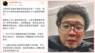 曾扬言千枚核弹毁地球 赵盛烨除夕车祸险丧命