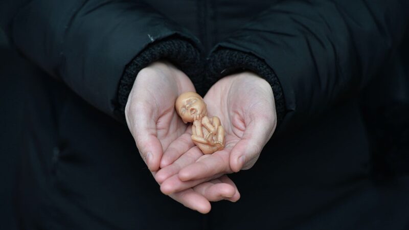 【名家專欄】禁止人類胎兒養殖 防患於未然