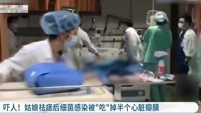 浙江20歲女大學生除痣 心臟被細菌「吃」掉一半