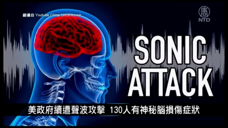 國際新聞簡訊：美政府續遭聲波攻擊 130人有神祕腦損傷症狀