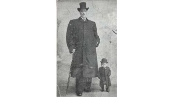 世上唯一前半生侏儒後半生巨人2米41 侏儒症 巨人症 亞當 雷納爾 新唐人中文電視台在線