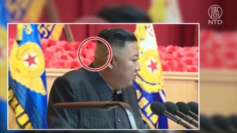 學者：金正恩若倒下 全世界僅15人知道