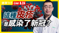 【重播】1/5新冠患者 皮膚紅疹是唯一症狀