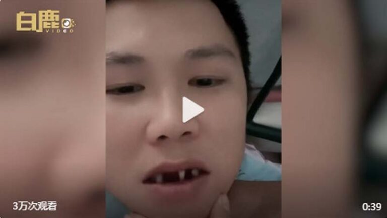 江西男看《長津湖》跟風吃凍土豆 慘拔3顆牙