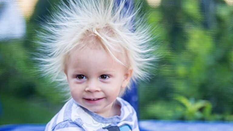 啪啪！常發生靜電？5招從內到外改善