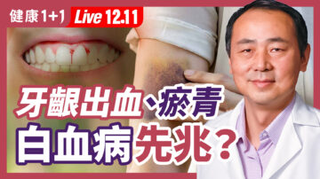 【健康1+1】牙齦出血、瘀青 是白血病先兆？