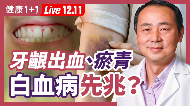 【健康1+1】牙齦出血、瘀青 是白血病先兆？