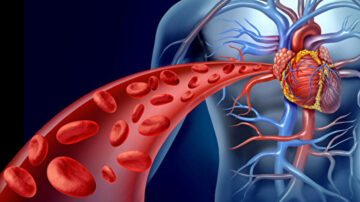 降低坏胆固醇的自然方法！逆转心脏病