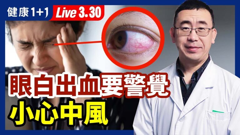 【健康1+1】眼白出血要警覺 小心中風