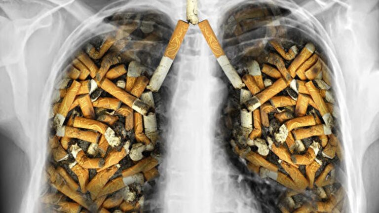 為什麼大多數菸民沒有患肺癌 研究析因